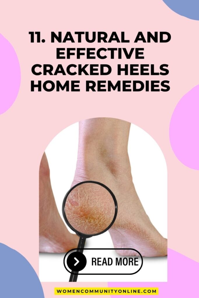 11. Natural and Effective Cracked Heels home remedies