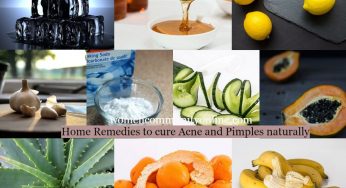 Home Remedies To Cure Acne And Pimples