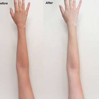 Remove Sun Tan Naturally