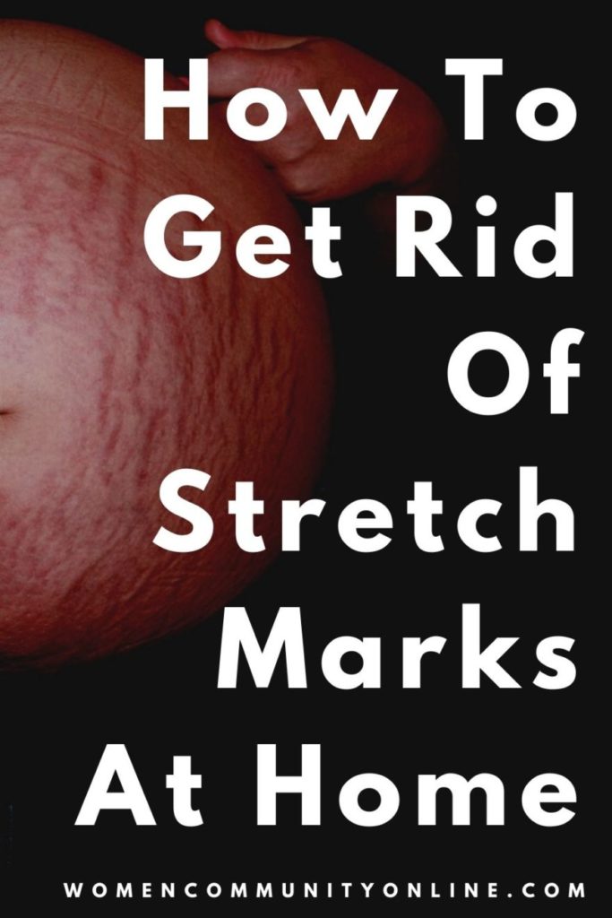 How To Get Rid Of Stretch Marks At Home