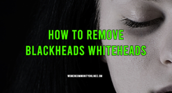 How To Remove Blackheads Whiteheads