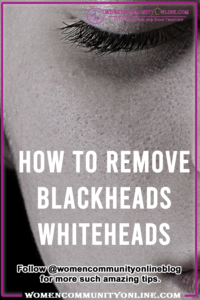 How To Remove Blackheads Whiteheads
